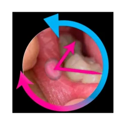 Die moderne Hausfrau AphtoFix Plus, 10 g