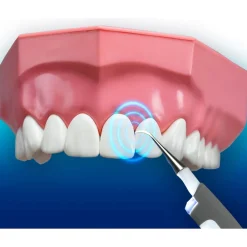 Die moderne Hausfrau DentaPic Sonic Schall-Zahnreiniger