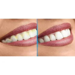 Die moderne Hausfrau DentaPic Sonic Schall-Zahnreiniger