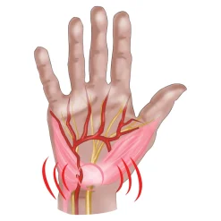 Die moderne Hausfrau Handgelenkbandage rechts